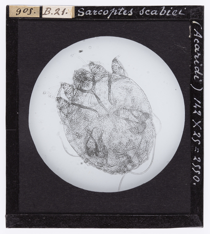 RGD-S-000B21-0905 - Sarcoptes scabiei (Acaridi) ingrandito al microscopio - Data dello scatto: 1914 - Archivi Alinari, Firenze