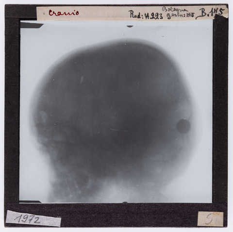 RGD-S-00B175-1972 - Radiografia di un cranio umano - Data dello scatto: 01/1915 - Archivi Alinari, Firenze